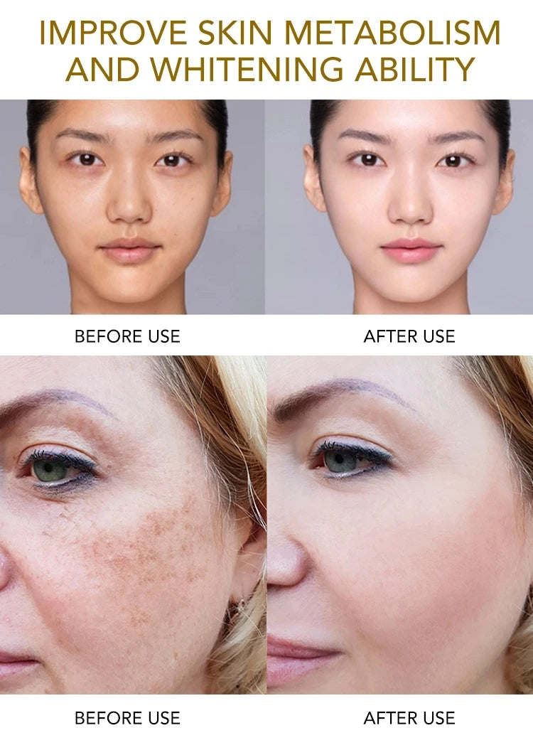AILKE Whitening Dark Spots Remove Facial Skin Care Cream With Collagen, Reduce Freckles, Wrinkles, Women Premium Face Product