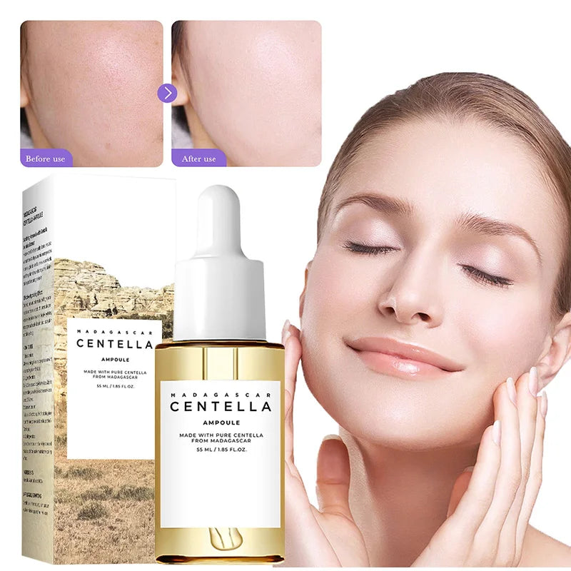 Madagascar Centella Asiatica Ampoule Facial Serum,Facial Moisturizing,Brightening,Tightening and Repair,Reduce Fine Lines/Pores