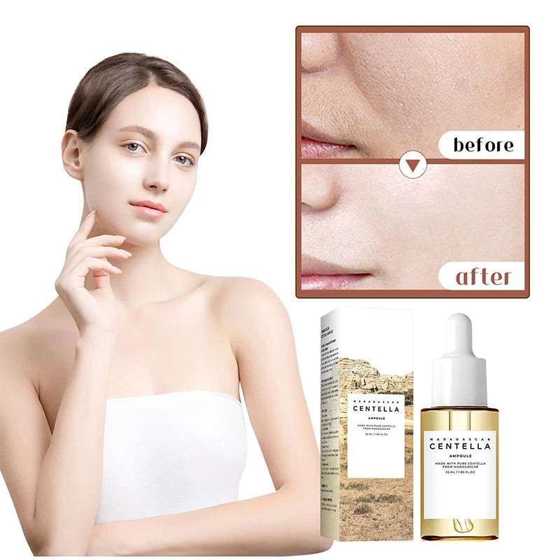 Madagascar Centella Asiatica Ampoule Facial Serum,Facial Moisturizing,Brightening,Tightening and Repair,Reduce Fine Lines/Pores