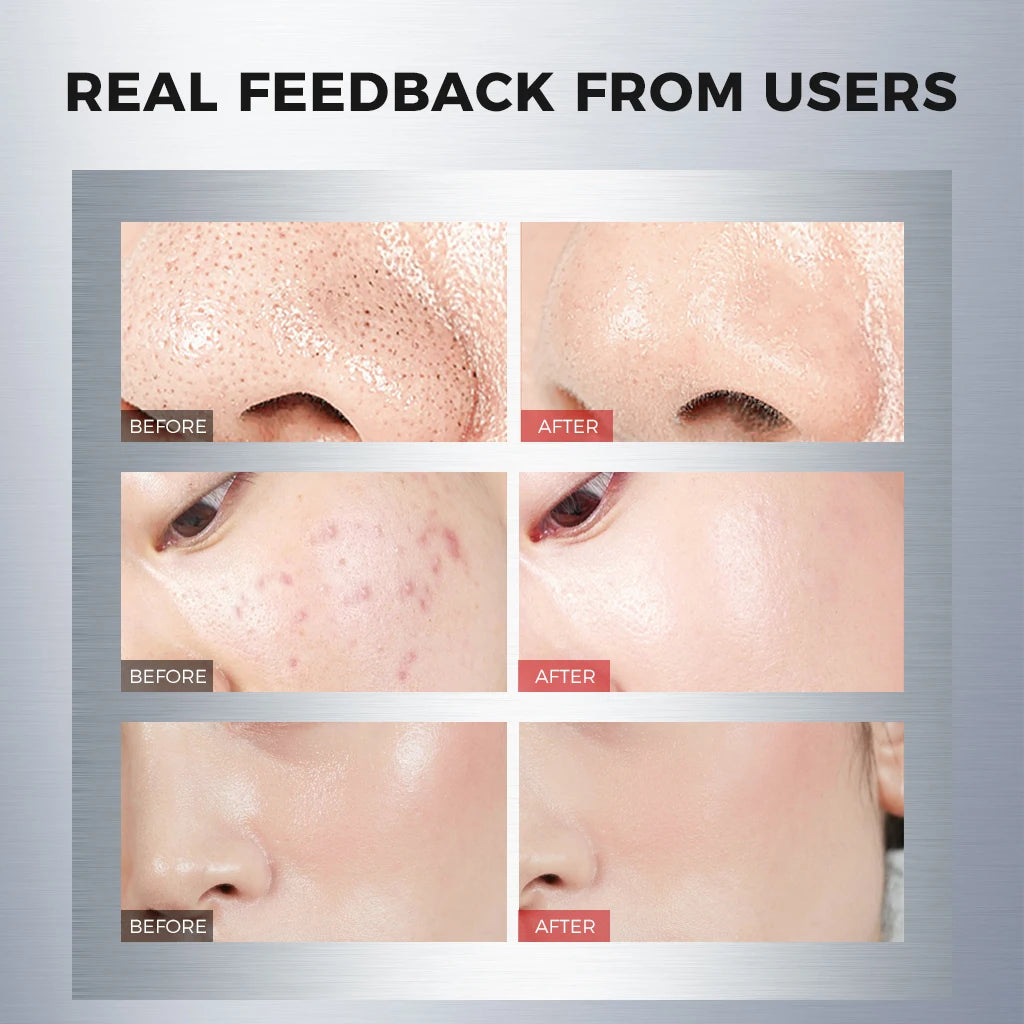 110g × 3 NING Clarifying Clay Mask – Triple-Action Deep Cleanser with Amino Acids, Oil Control & Gentle Pore Care